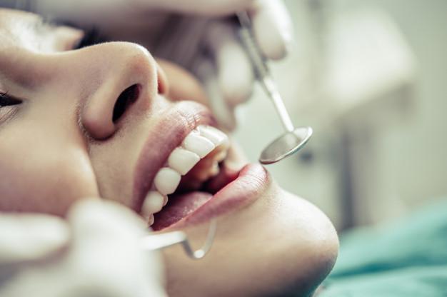 Plano odontológico Unimed: tudo o que você precisa saber
